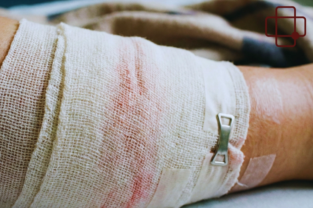 Common Medical Treatment Options for Infected Coral Cuts in Lombok