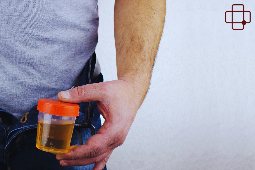 Why Does Your Urine Look Darker While Traveling in Lombok